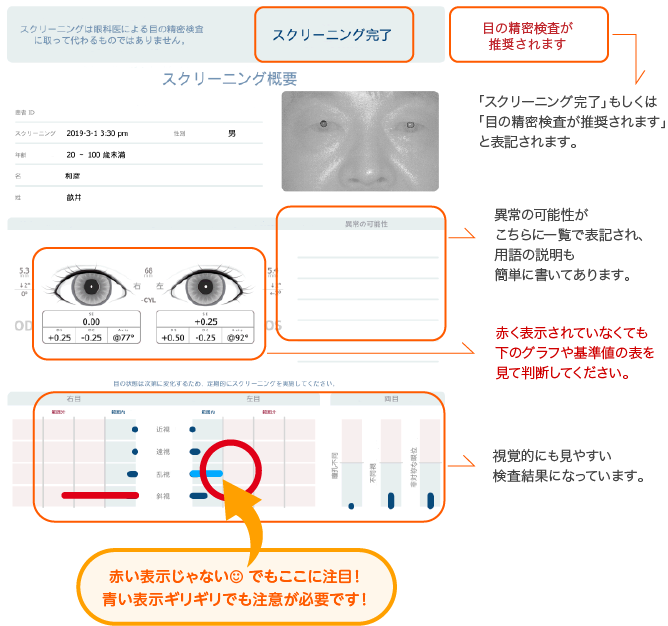 弱視スクリーニング検査結果サンプル